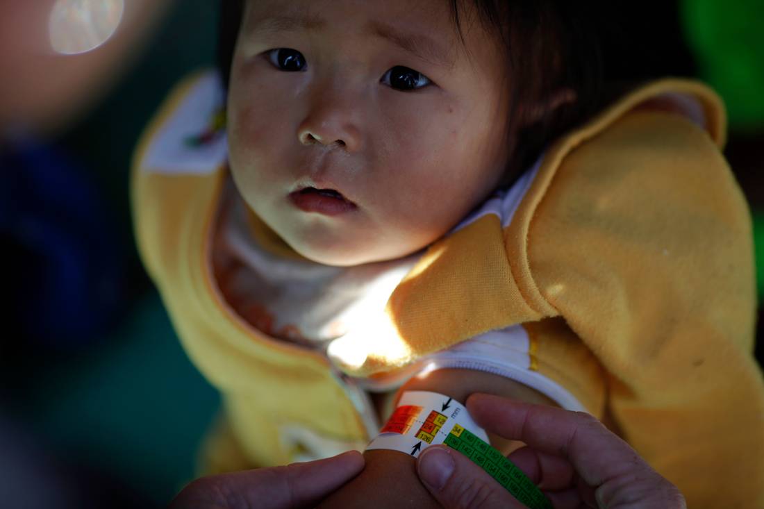 Голод в северной корее. Голодающие дети Северной Кореи. Северокорейские дети голод.