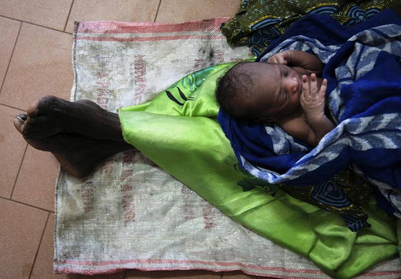 In Uganda, parents seek genital surgery for intersex babies Adult Picture